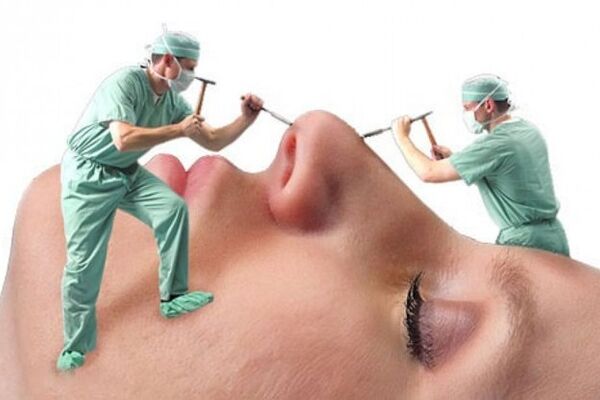 تب تند جراحی‌های زیبایی در کشور/ مانور دلالان در فضای مجازی 