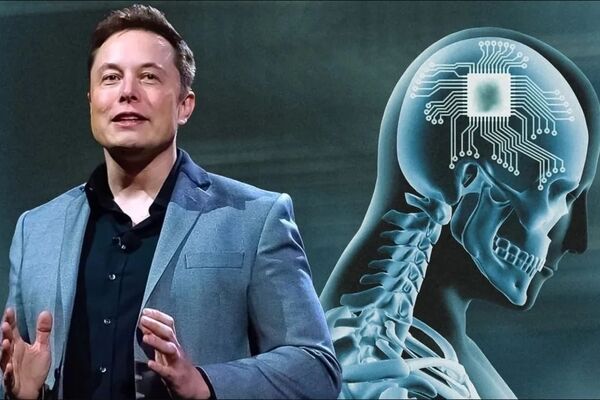 جذب سرمایه ایمپلنت مغزی ایلان ماسک